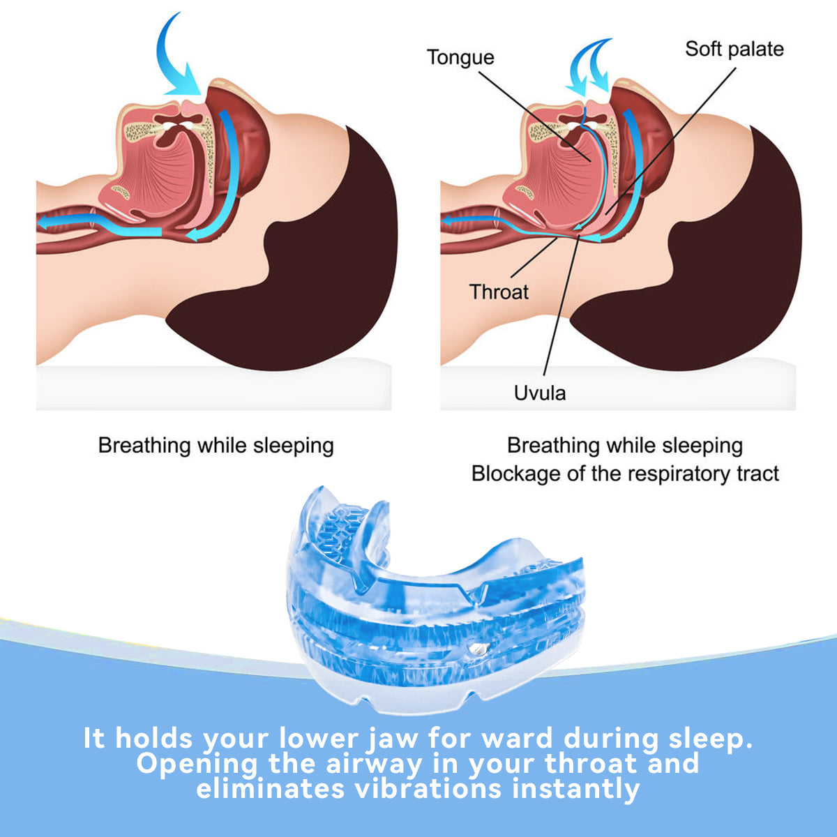 Anti Snore
