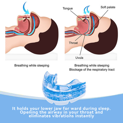 Anti Snore